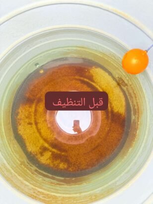 مكافحة الحشرات والقوارض